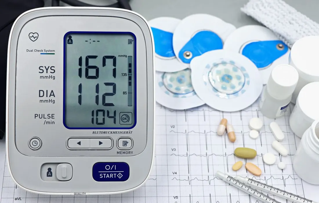 A blood-pressure monitor and other medical items on an ECG printout.